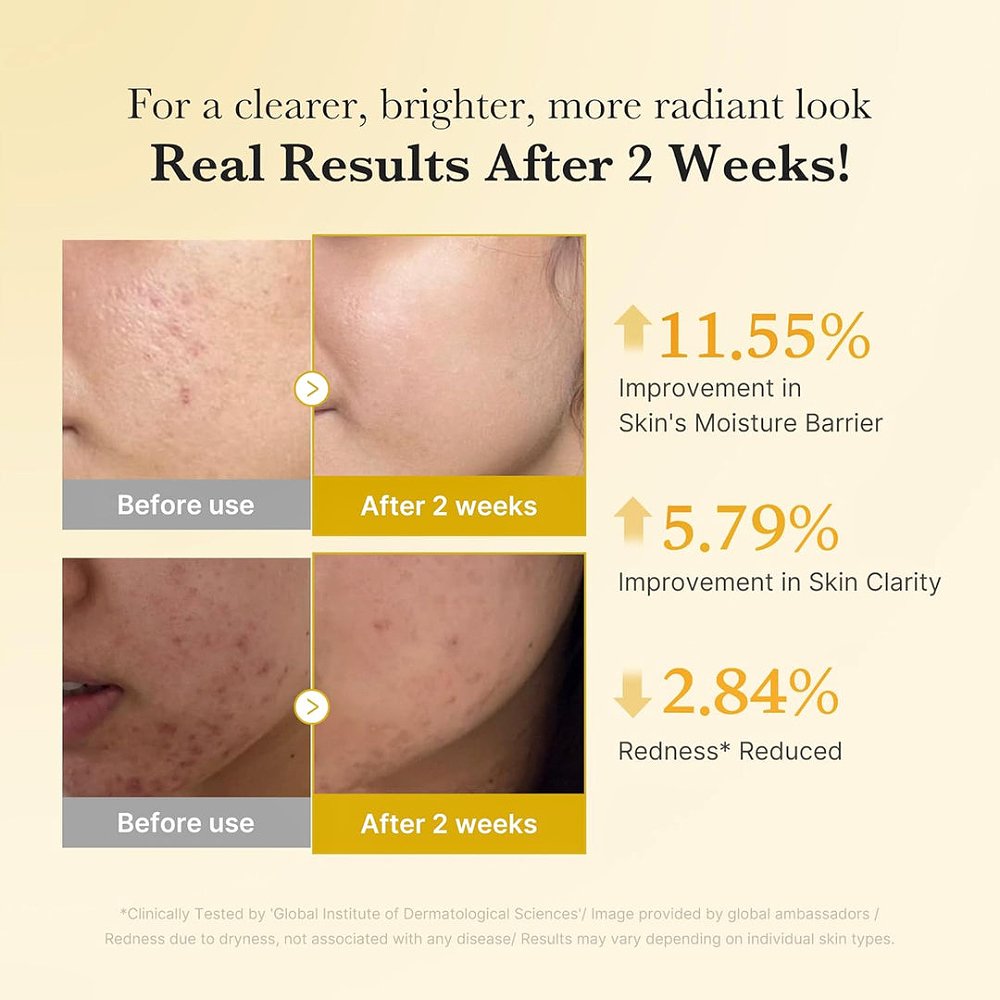 Medicube kojic acid turmaric niacinamide serum - Image 4